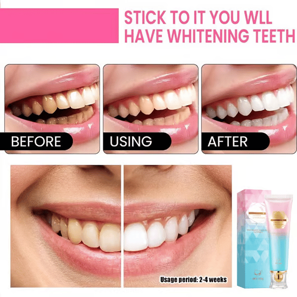 Luhaka®  🔥🎉Buy 2 Get 1 Free-🦷 Niacinamide Whitening Toothpaste D03