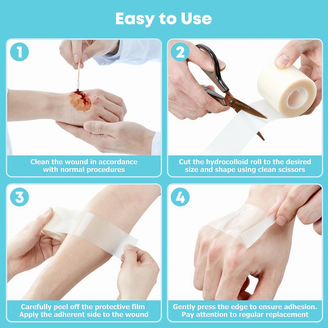 LUHAKA®🔥✨HOT SALE 49% OFF🔥-Wound Care Hydrocolloid Rolls D01