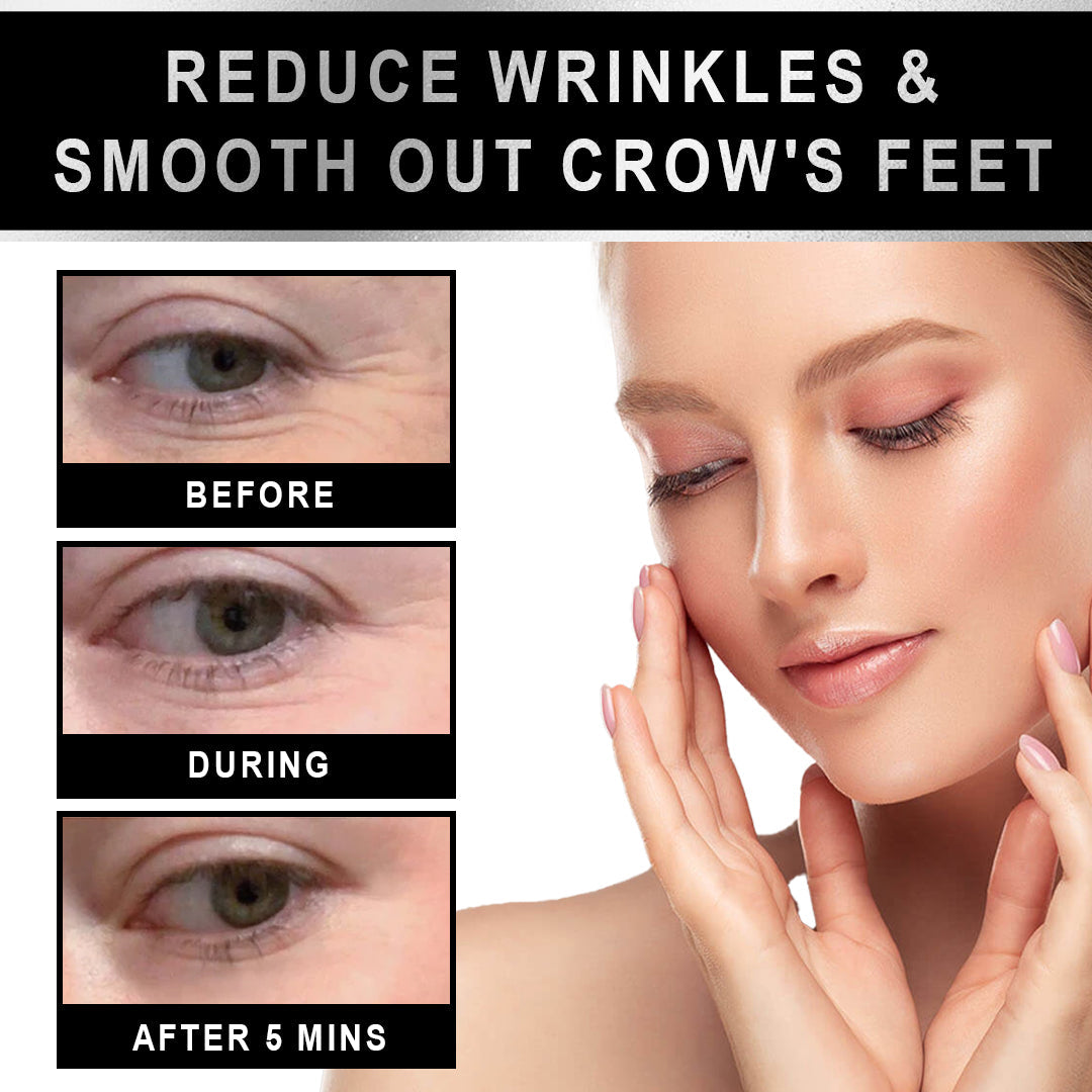 KISSHI™ Clinical SkinCare Instant Eye Tightener 💫3