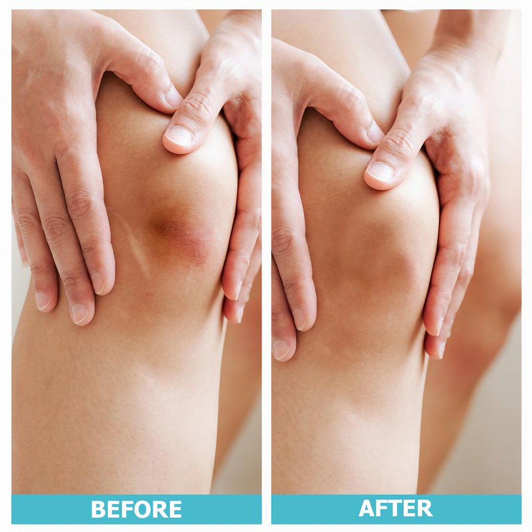 LUHAKA®🔥✨HOT SALE 49% OFF🔥-Wound Care Hydrocolloid Rolls D01