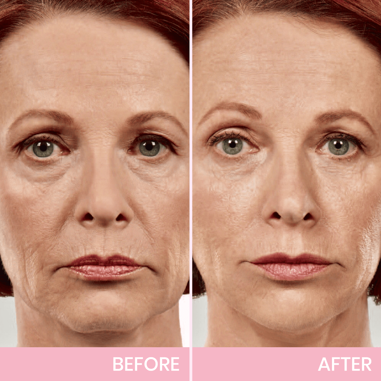 Luhaka™ V-Face Lifting Invisible Adhesive Tape 6