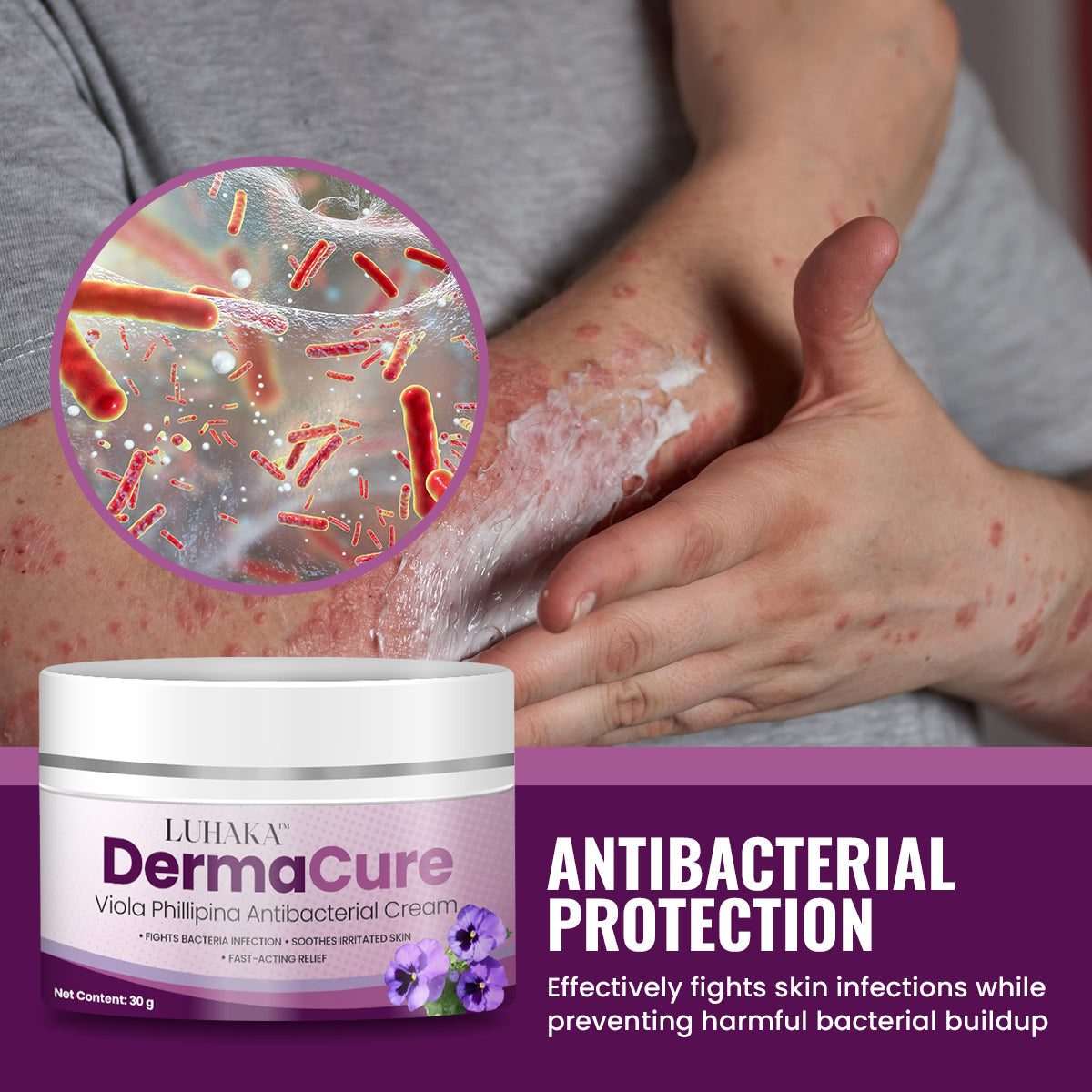 Luhaka™ DermaCure Viola Phillipina Antibacterial Cream 🪻1