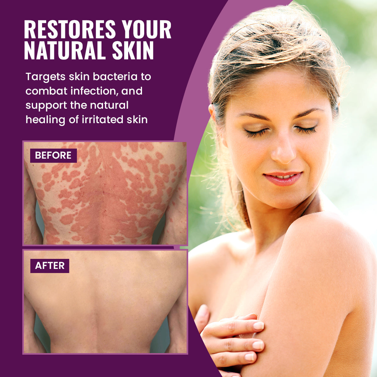 Luhaka™ DermaCure Viola Phillipina Antibacterial Cream 🪻1