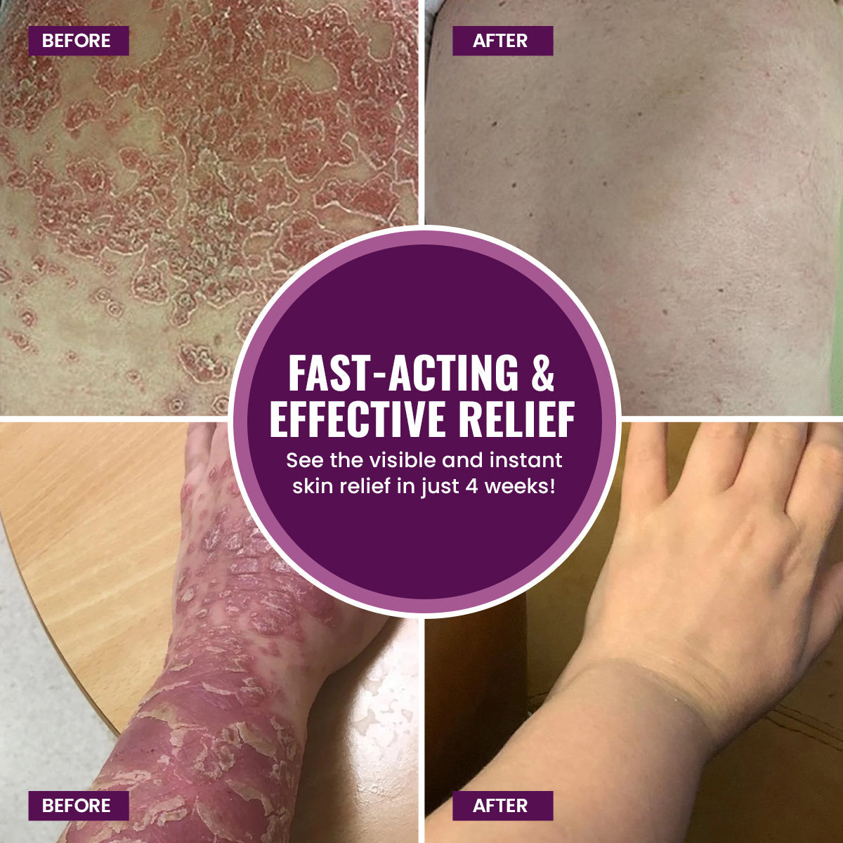 Luhaka™ DermaCure Viola Phillipina Antibacterial Cream 🪻1