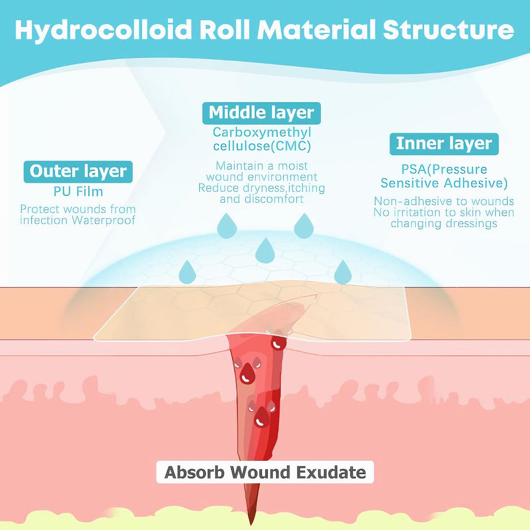 LUHAKA®🔥✨HOT SALE 49% OFF🔥-Wound Care Hydrocolloid Rolls D01