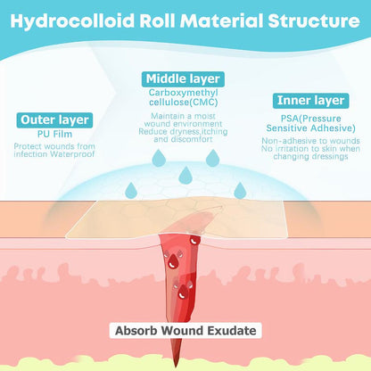 LUHAKA®🔥✨HOT SALE 49% OFF🔥-Wound Care Hydrocolloid Rolls D01