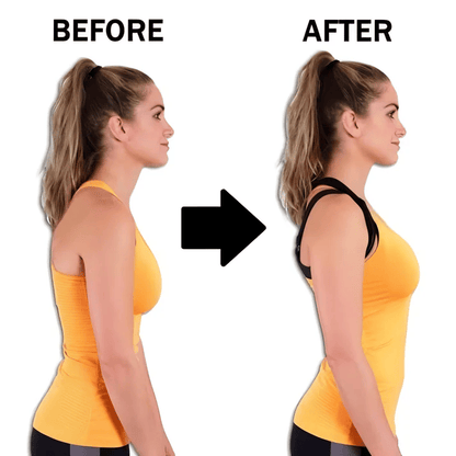 Sfrcord® 🔥2025 Summer Hot Sale 50% OFF-✨TrueForm Posture Correcting Bra D02
