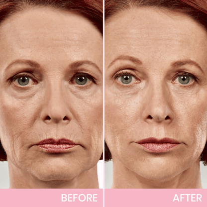Luhaka™ V-Face Lifting Invisible Adhesive Tape 6
