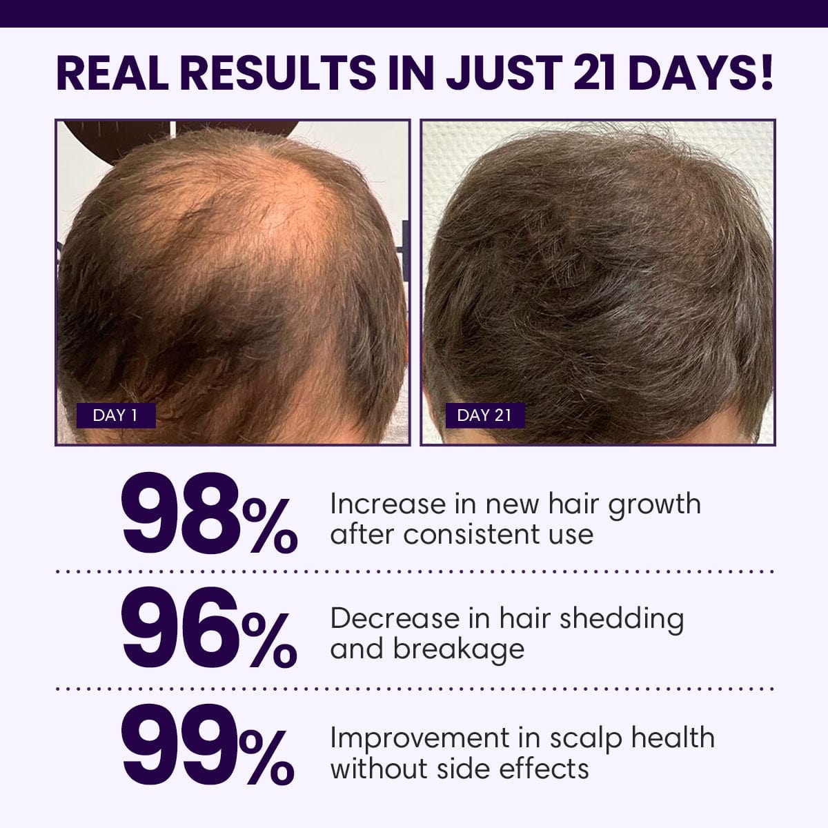 Luhaka™ FollicaMax 25,000 MCG Hair Growth Support ⚙️4